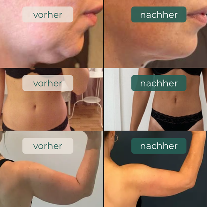 Mirelia Lymphdrainage